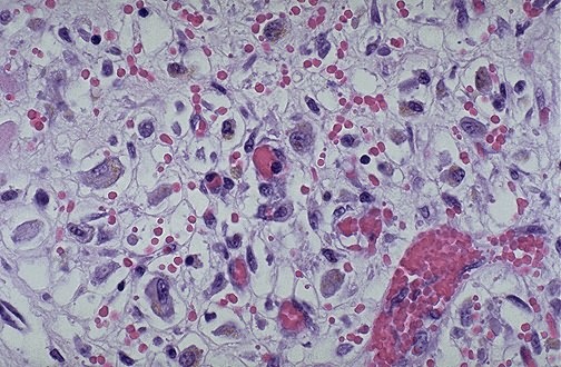 caninum